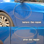 Car Dent Removal Kit | Paint-Safe & Portable | Complete Kit