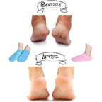Moisturizing Socks | Vitamin E Gel Lining & Non-Slip Sole