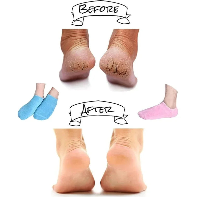 Moisturizing Socks | Vitamin E Gel Lining & Non-Slip Sole