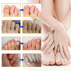 Nail Fungus Patch | Deep-Acting Antifungal & Medical Fleece | Pack of 2