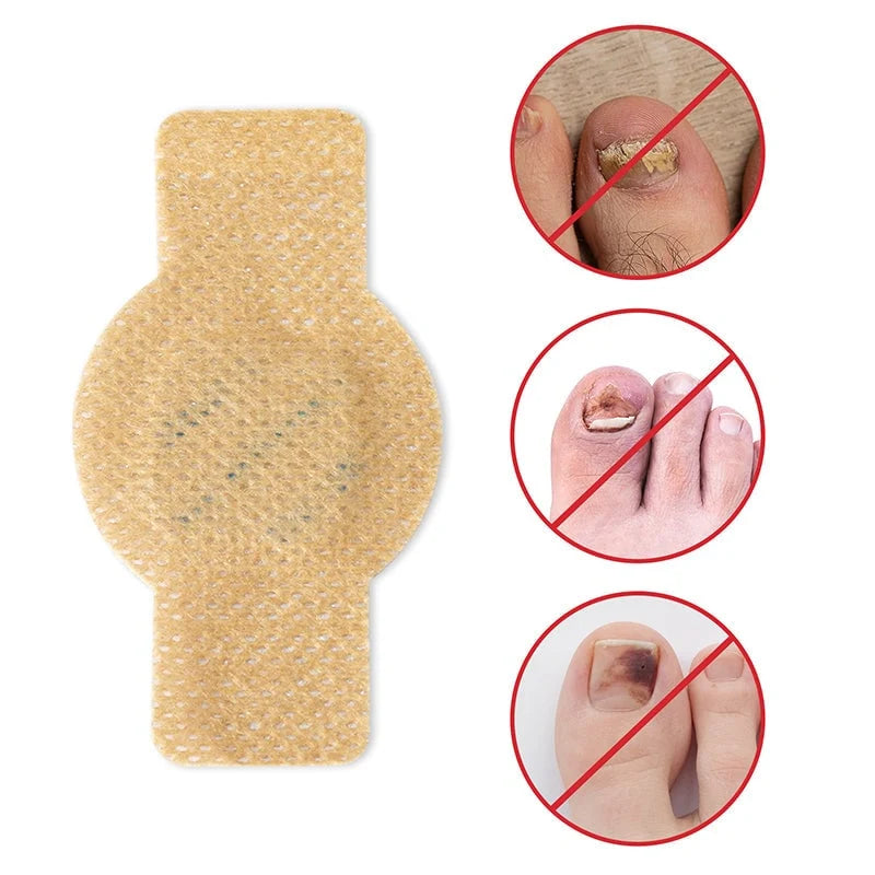Nail Fungus Patch | Deep-Acting Antifungal & Medical Fleece | Pack of 2