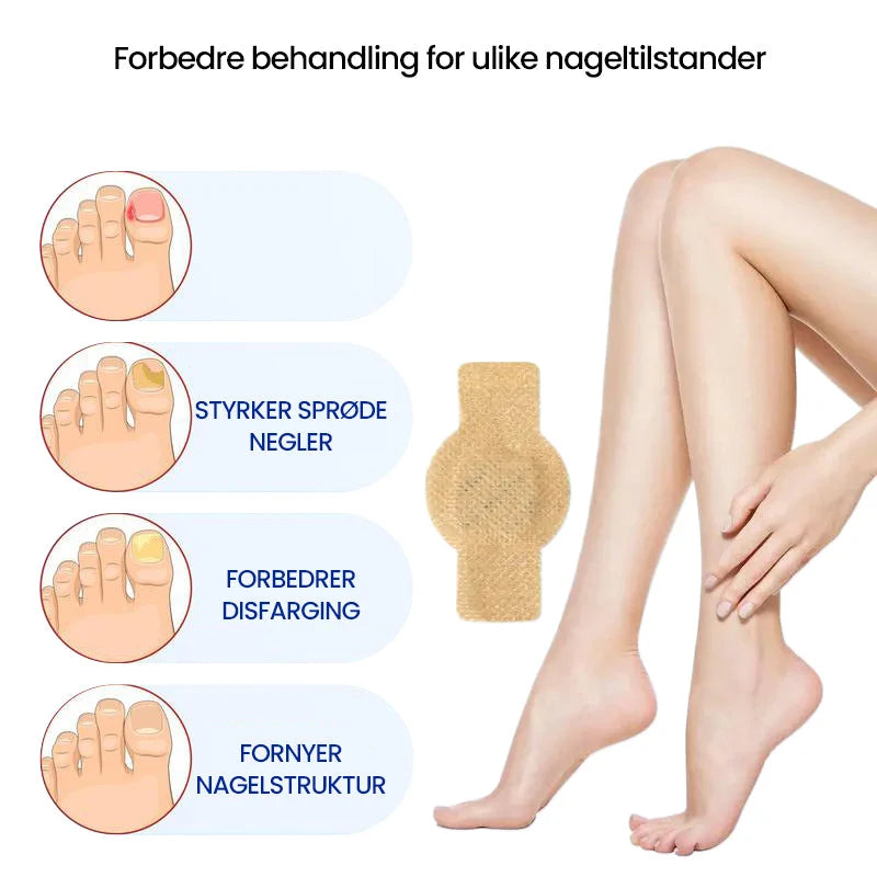 Nail Fungus Patch | Deep-Acting Antifungal & Medical Fleece | Pack of 2