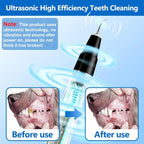 Pet Tartar Remover | Ultrasonic & Painless