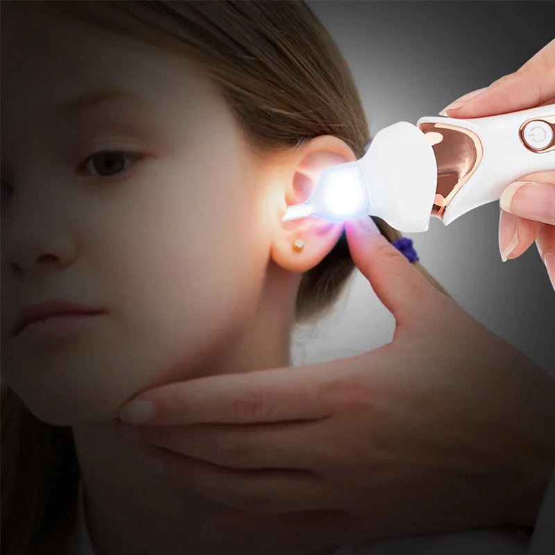 Electric Ear Cleaner | 5-in-1 Soft Silicone Tips | USB Rechargeable