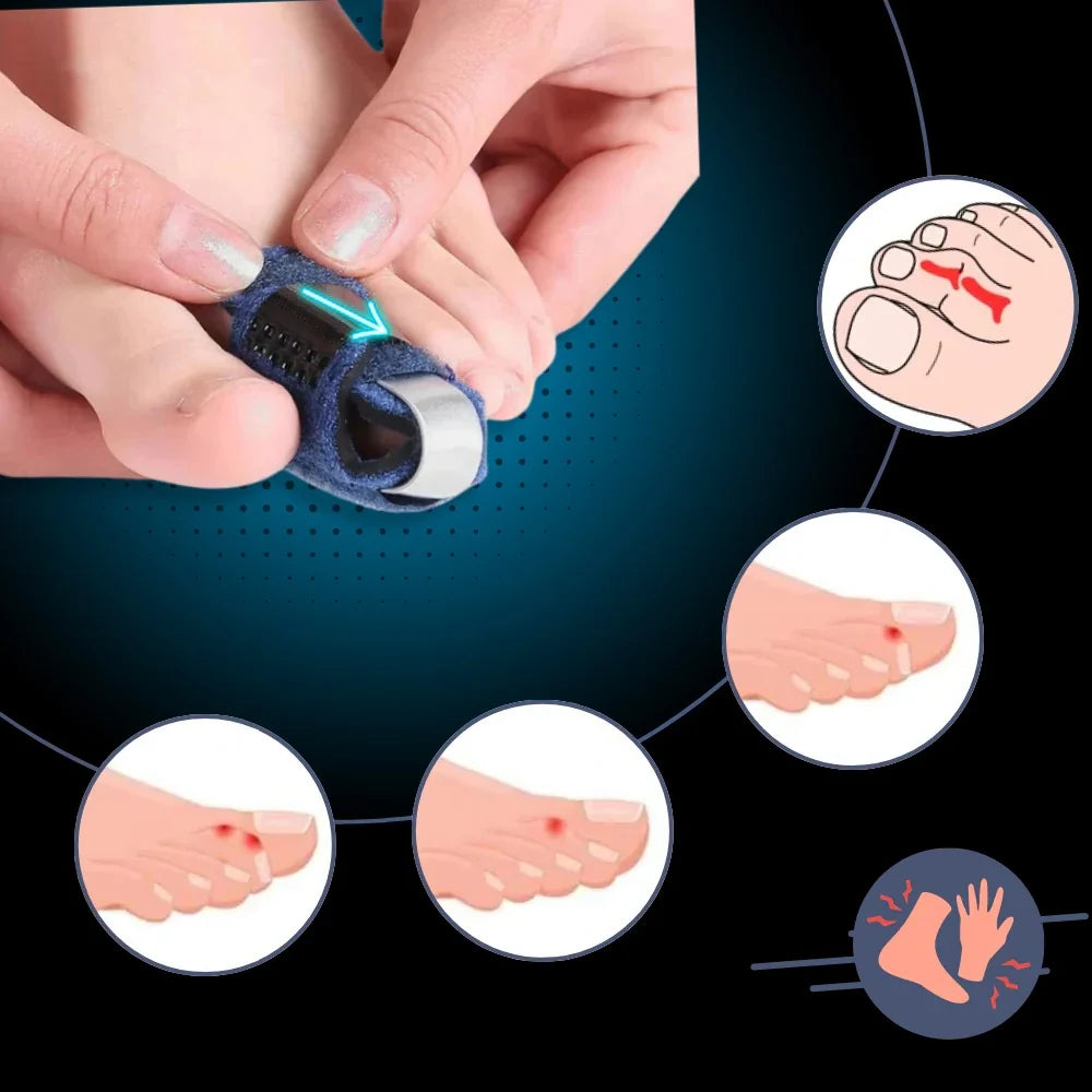 Toe Straightener | Breathable Low-Profile & Adjustable Support