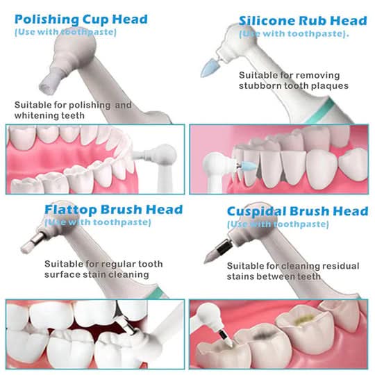 Tooth Cleaner | Ultrasonic Stainless Steel Tip | LED Light